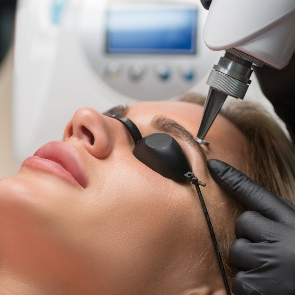 Despigmentação de Sobrancelhas